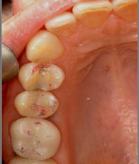 painful-teeth.jpg